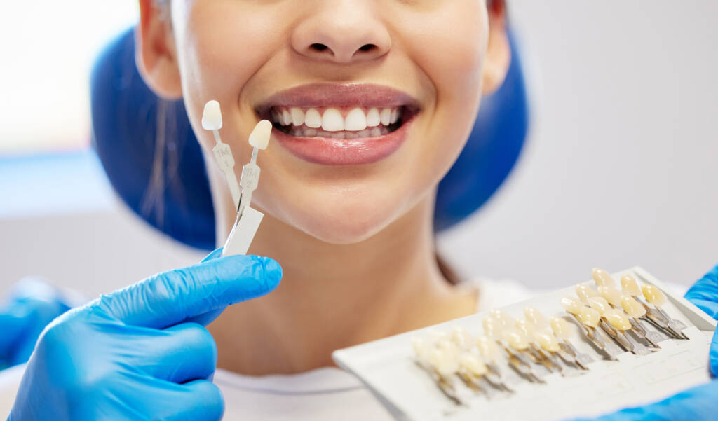 dental veneers in dubai